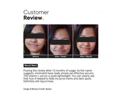 Minimalist 10% Vitamin C Serum (30 ML)