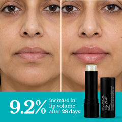 Be Clinical Lip Reset Balm | Reduces Lip Wrinkles and Hyperpigmentation