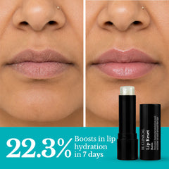 Be Clinical Lip Reset Balm | Reduces Lip Wrinkles and Hyperpigmentation