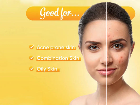 Ozone Acne Check Face Wash ( 100 GM )