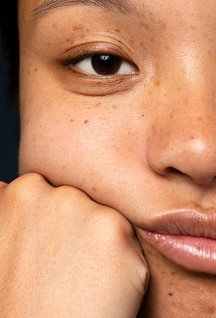 Tab Image Pigmentation